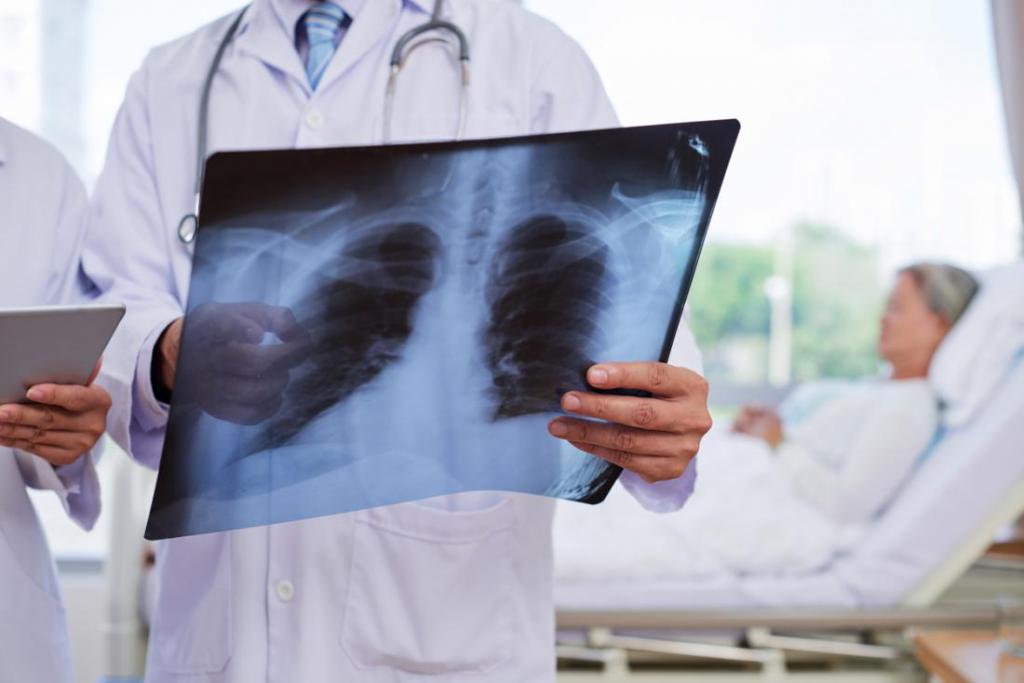Standarder för behandling av lunginflammation hos vuxna
