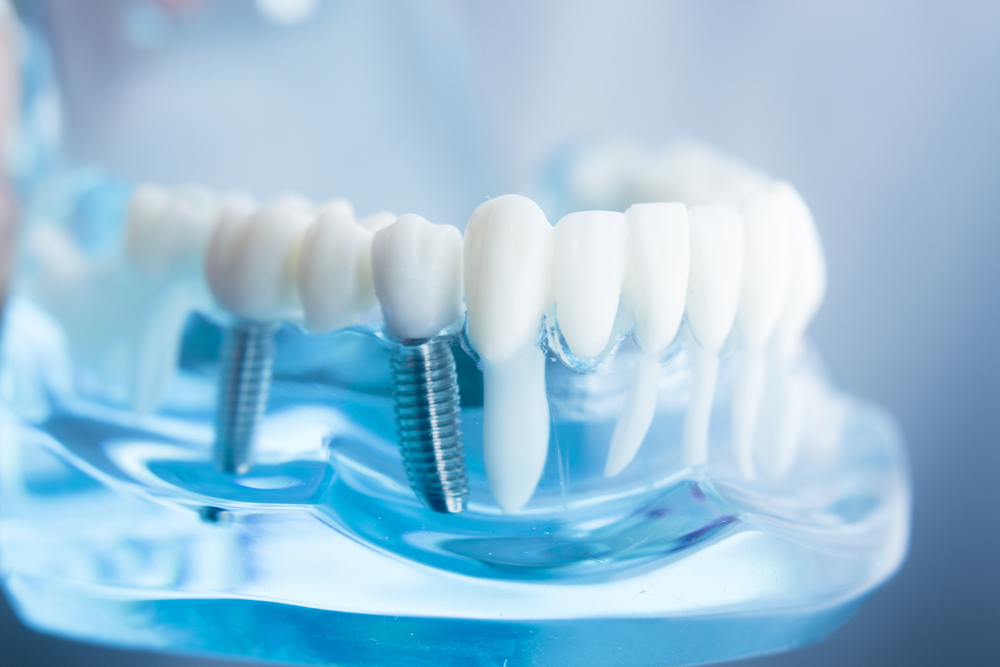 the right to preferential dental prosthetics for labor veterans